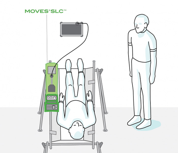 MOVES® SLC™ top mount diagram