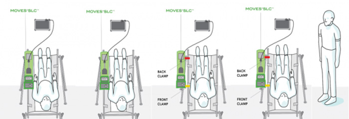 MOVES® SLC™ top mount and side mount diagram